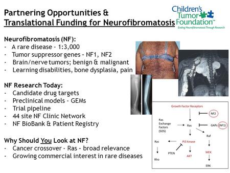 Partnering Opportunities & Translational Funding for Neurofibromatosis Neurofibromatosis (NF): - A rare disease - 1:3,000 - Tumor suppressor genes – NF1,