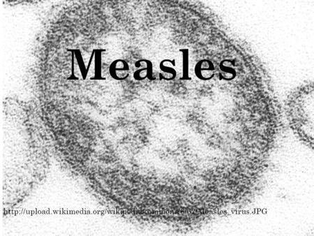 Measles