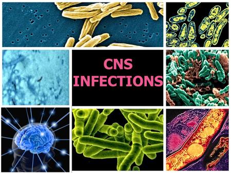 CNS INFECTIONS.