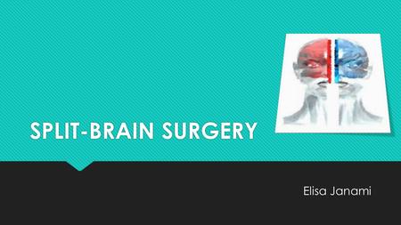 SPLIT-BRAIN SURGERY Elisa Janami.