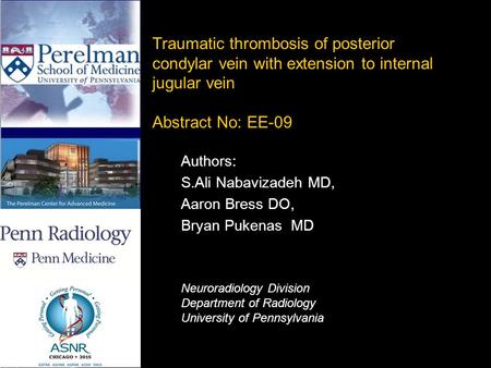 PENN RADIOLOGY THE ROOTS OF RADIOLOGICAL EXCELLENCE Traumatic thrombosis of posterior condylar vein with extension to internal jugular vein Abstract No: