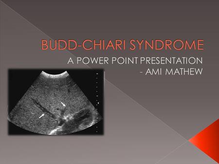 A POWER POINT PRESENTATION - AMI MATHEW