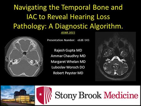 Navigating the Temporal Bone and IAC to Reveal Hearing Loss Pathology: A Diagnostic Algorithm. ASNR 2015 Presentation Number:   eEdE-143 Rajesh Gupta.