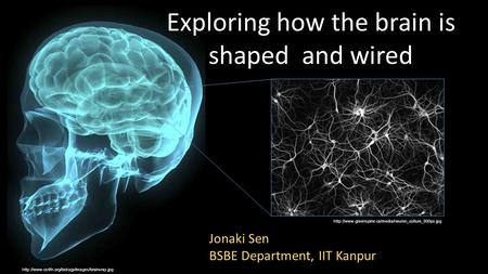 Exploring how the brain is shaped and wired