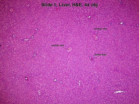 Slide 1, Liver, H&E, 4x obj central vein portal triad central vein.