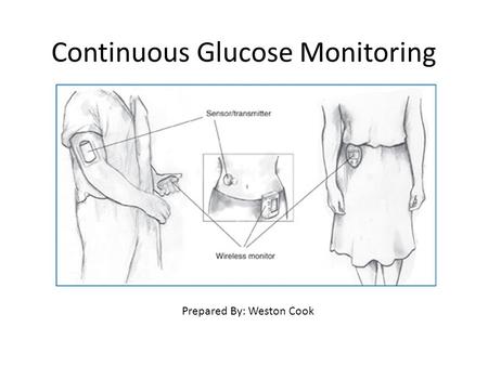 Continuous Glucose Monitoring