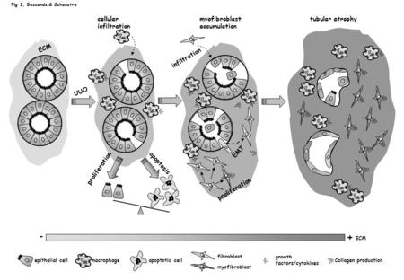 - + cellular infiltration myofibroblast accumulation tubular atrophy