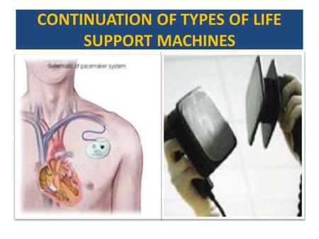 CONTINUATION OF TYPES OF LIFE SUPPORT MACHINES. HEART/LUNG BY PASS CARDIOPULMONARY BY PASS(CPB) IS A TECHNIQUE THAT TEMPORARILY TAKES OVER THE FUNCTION.