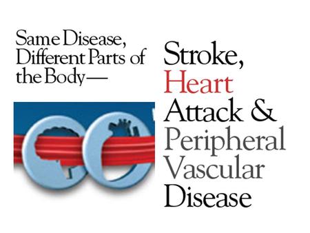 Stroke and Coronary Disease