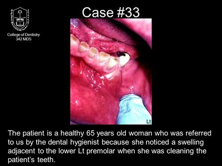 The patient is a healthy 65 years old woman who was referred to us by the dental hygienist because she noticed a swelling adjacent to the lower Lt premolar.