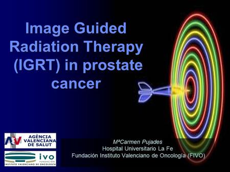 Image Guided Radiation Therapy (IGRT) in prostate cancer MªCarmen Pujades Hospital Universitario La Fe Fundación Instituto Valenciano de Oncología (FIVO)