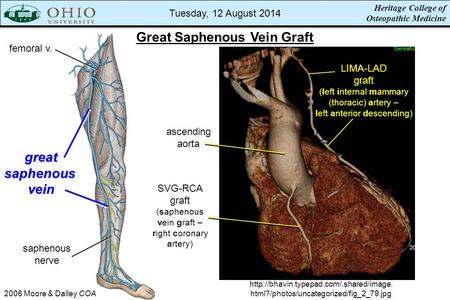 Heritage College of Osteopathic Medicine Great Saphenous Vein Graft 2006 Moore & Dalley COA greatsaphenousvein femoral v. saphenous nerve