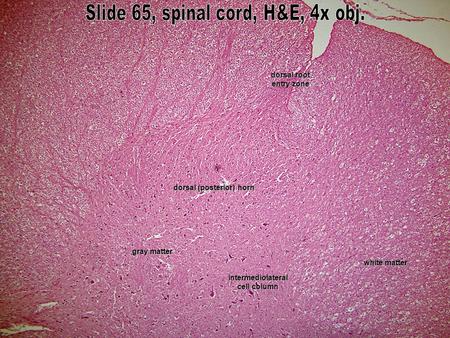 Dorsal (posterior) horn dorsal root entry zone intermediolateral cell column white matter gray matter.