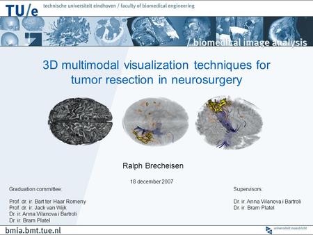 3D multimodal visualization techniques for tumor resection in neurosurgery Ralph Brecheisen Graduation committee: Prof. dr. ir. Bart ter Haar Romeny Prof.