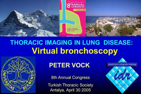 PETER VOCK 8th Annual Congress Turkish Thoracic Society Antalya, April 30 2005 Virtual bronchoscopy THORACIC IMAGING IN LUNG DISEASE: