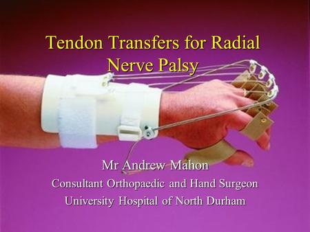 Tendon Transfers for Radial Nerve Palsy Mr Andrew Mahon Consultant Orthopaedic and Hand Surgeon University Hospital of North Durham.