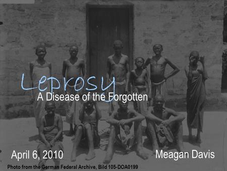 “the biggest disease of our time is not leprosy or tuberculosis, but the feeling of being unwanted ”- Mother Teresa April 6, 2010 Photo from the German.