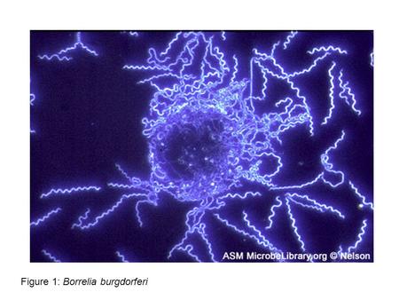 Figure 1: Borrelia burgdorferi. Spontaneous Generation Controversy.