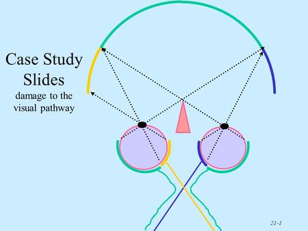 Case Study Slides damage to the visual pathway