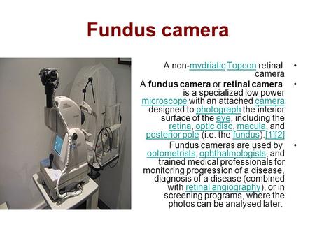 Fundus camera A non-mydriatic Topcon retinal camera