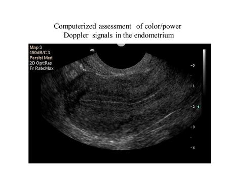 Computerized assessment of color/power Doppler signals in the endometrium.