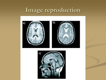 Image reproduction. Slice selection FBP Filtered Back Projection.