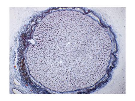 optic nerve Striate Cortex (V1) Hubel & Wiesel 1 deg.