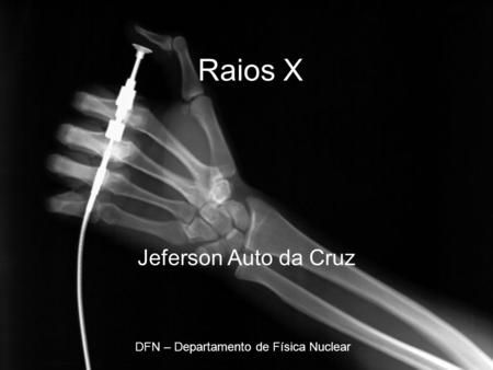 Raios X Jeferson Auto da Cruz DFN – Departamento de Física Nuclear.