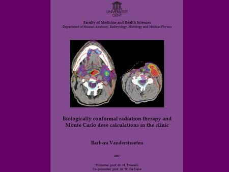 What is radiation therapy (RT)? Cancer treatment Tumor versus normal tissues External photon beam RT.