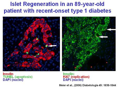 Replication NeoformationApoptosis  -cell mass IGF-1 Receptor pY ß-Cell Plasma Membrane ß-Cell Nucleus IGF-1 Induced Activation of IRS-2 Signaling in.