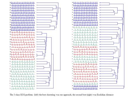 The 3-class ECG problem: (left) the best clustering was our approach, the second best (right) was Euclidian distance.