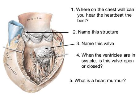 Where on the chest wall can