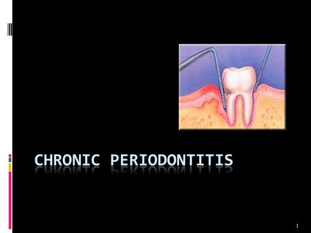 Chronic Periodontitis