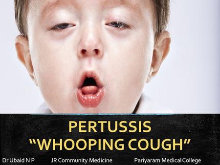 PERTUSSIS “WHOOPING COUGH” Dr Ubaid N P JR Community MedicinePariyaram Medical College.