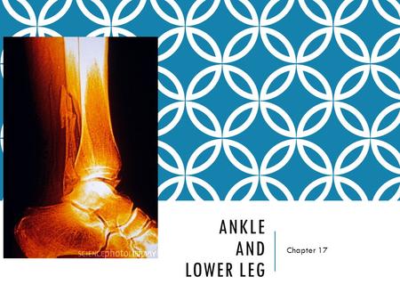 Ankle and Lower Leg Chapter 17.