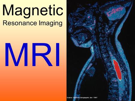 Magnetic Resonance Imaging