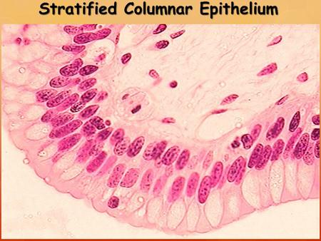 Stratified Columnar Epithelium