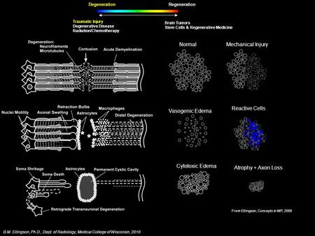 DegenerationRegeneration Traumatic Injury Degenerative Disease Radiation/Chemotherapy Brain Tumors Stem Cells & Regenerative Medicine B.M. Ellingson, Ph.D.,