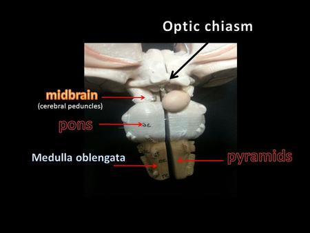 (cerebral peduncles). vertebral arteries Anterior spinal artery Posterior inferior cerebellar artery Basilar Artery Labyrinthine artery Anterior.