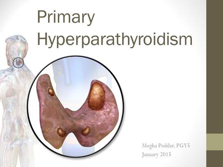 Primary Hyperparathyroidism