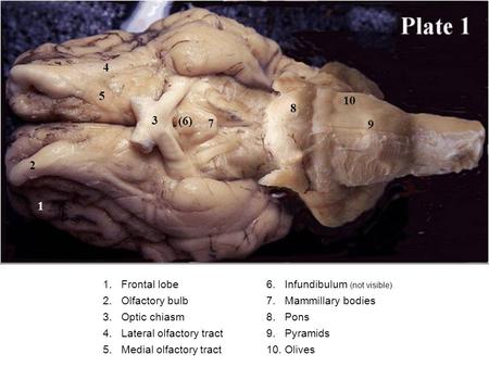 1 2 3 (6) 4 1.Frontal lobe 2.Olfactory bulb 3.Optic chiasm 4.Lateral olfactory tract 5.Medial olfactory tract 6.Infundibulum (not visible) 7.Mammillary.