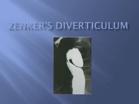  Posterior Diverticulum with the neck originating at a site proximal to the Upper esophageal sphincter  First described by Ludlow in 1767, named for.