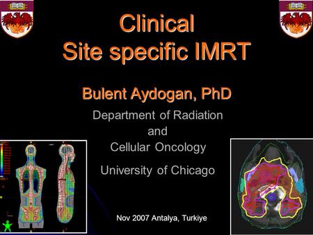 Clinical Site specific IMRT Bulent Aydogan, PhD Department of Radiation and Cellular Oncology University of Chicago Nov 2007 Antalya, Turkiye.