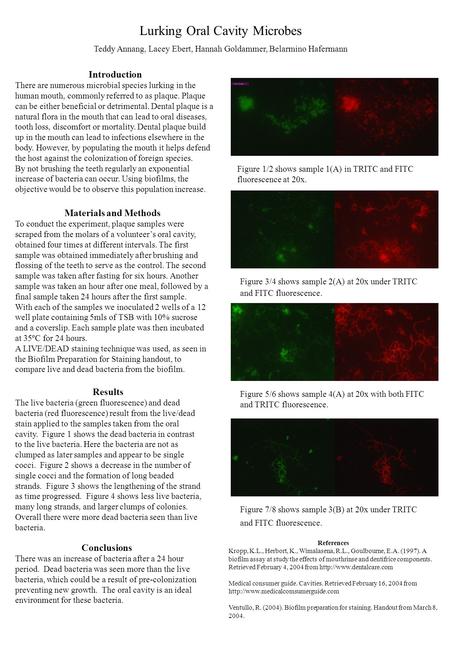 Lurking Oral Cavity Microbes Teddy Annang, Lacey Ebert, Hannah Goldammer, Belarmino Hafermann Introduction There are numerous microbial species lurking.