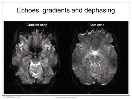 Psy 8960, Spring ‘07 Gradient and Spin Echoes1 Echoes, gradients and dephasing Gradient echoSpin echo.