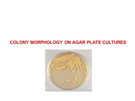 COLONY MORPHOLOGY ON AGAR PLATE CULTURES