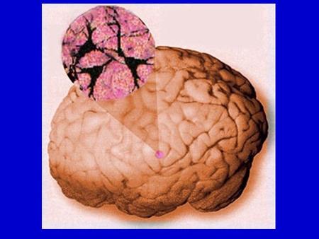 Overview of upcoming lectures 1/15: General introduction to vision, brain and the “minimal subscene” 1/17: Overview and discussion of projects 1/22: Visual.