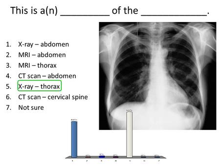 This is a(n) _________ of the ____________. 1.X-ray – abdomen 2.MRI – abdomen 3.MRI – thorax 4.CT scan – abdomen 5.X-ray – thorax 6.CT scan – cervical.