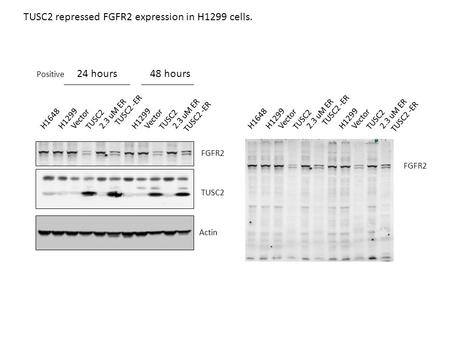 H1299 Vector H1648 TUSC2 TUSC2 -ER 2.3 uM ER H1299 Vector TUSC2 TUSC2 -ER 2.3 uM ER H1299 Vector H1648 TUSC2 TUSC2 -ER 2.3 uM ER H1299 Vector TUSC2 TUSC2.