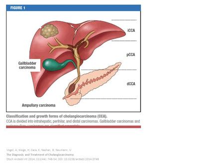 Vogel, A; Wege, H; Caca, K; Nashan, B; Neumann, U The Diagnosis and Treatment of Cholangiocarcinoma Dtsch Arztebl Int 2014; 111(44): 748-54; DOI: 10.3238/arztebl.2014.0748.